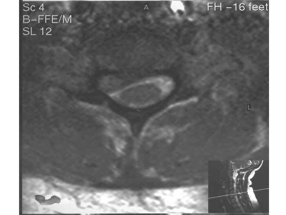 La diagnosi quando danni un dorso